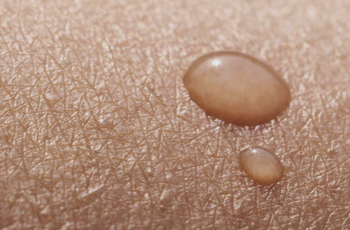 As nanopartículas e a penetração da pele: um desafio